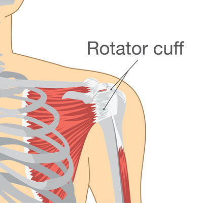 Rotator Cuff Strengthening Columbus Ohio